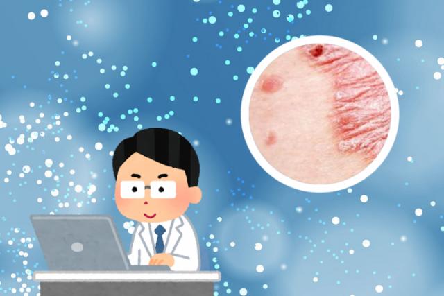 常见热疹分为五种类型图片
