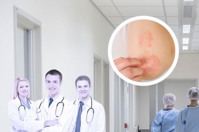 湿疹癣怎么治疗
