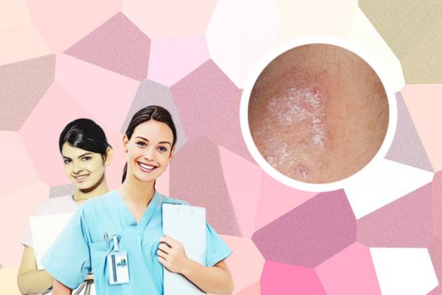 皮肤癣和湿疹的区别图片
