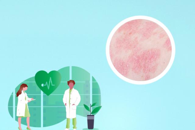 如何区分皮炎和湿疹