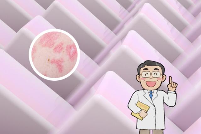 慢性湿疹和牛皮癣有区别吗
