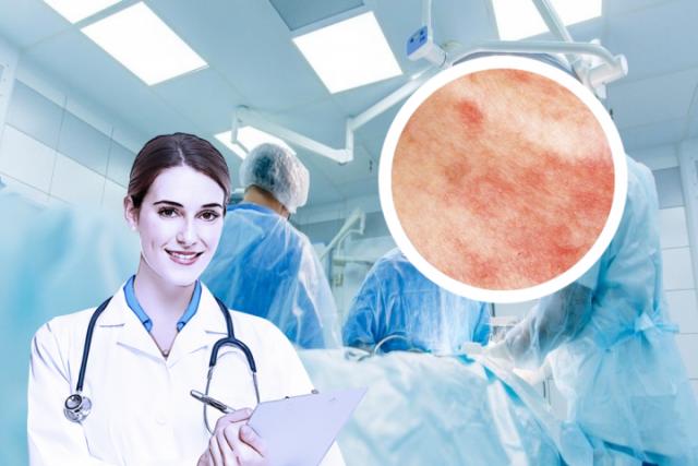 湿疹的皮肤病图片用什么药
