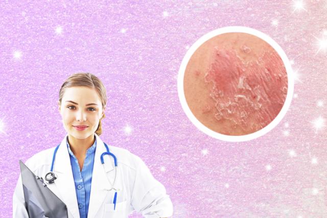 如何区分皮炎和湿疹

