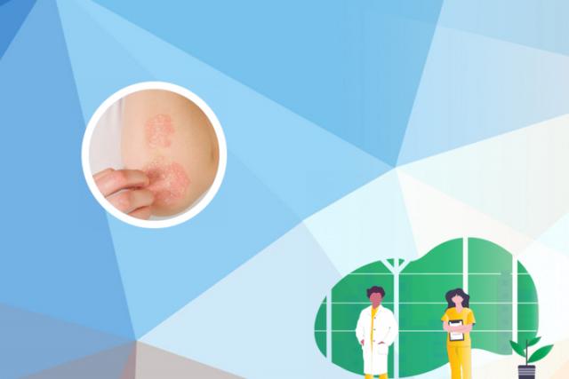 皮肤癣菌病能根治吗
