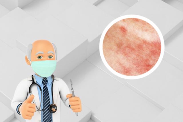 湿疹和皮癣应该用什么药
