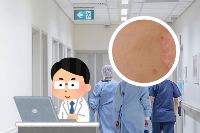湿疹癣怎么治疗
