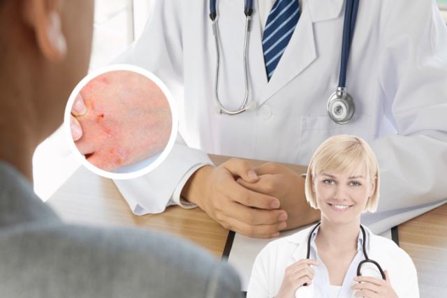 掌跖脓疱型银屑病与掌跖脓疱病的区别
