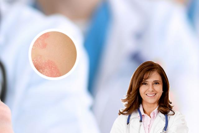 湿疹是什么原因造成的